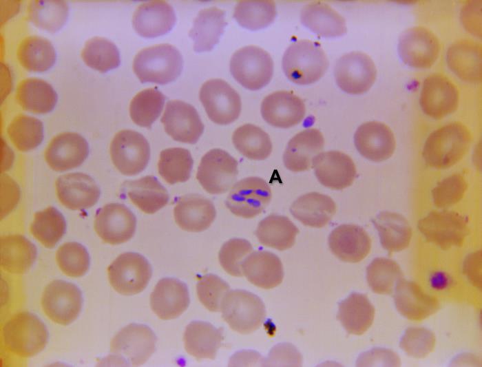 What is the Babesia tetrad seen in specialist microscopy?