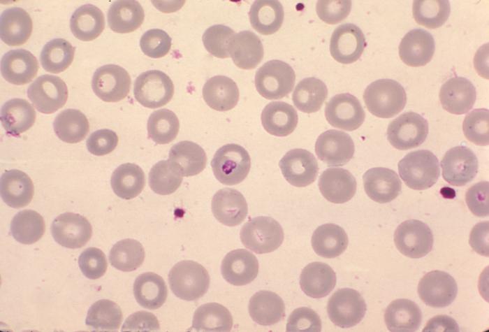 What can Babesia look like in a blood smear?
