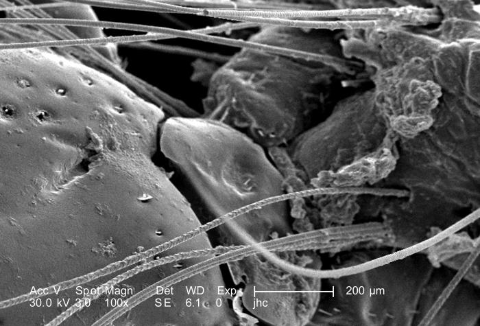 What can an engorged tick removed from a cat look like?