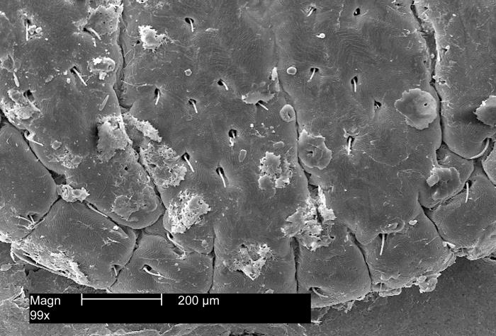 Scanning electron micrograph of the dorsal scutum of Dermacentor variabilis at 99 times magnification
